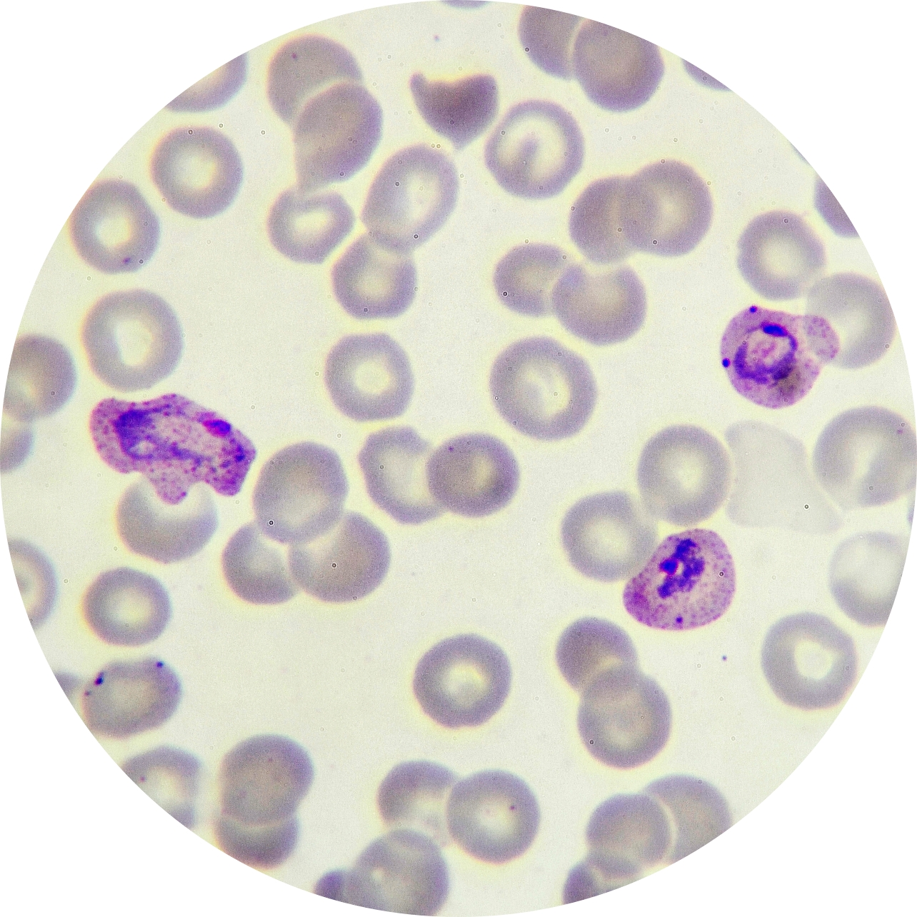 Malaria parasites in red blood cells
