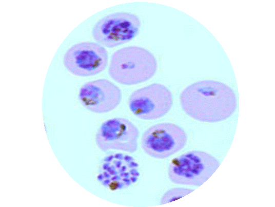 Malaria parasites in red blood cells