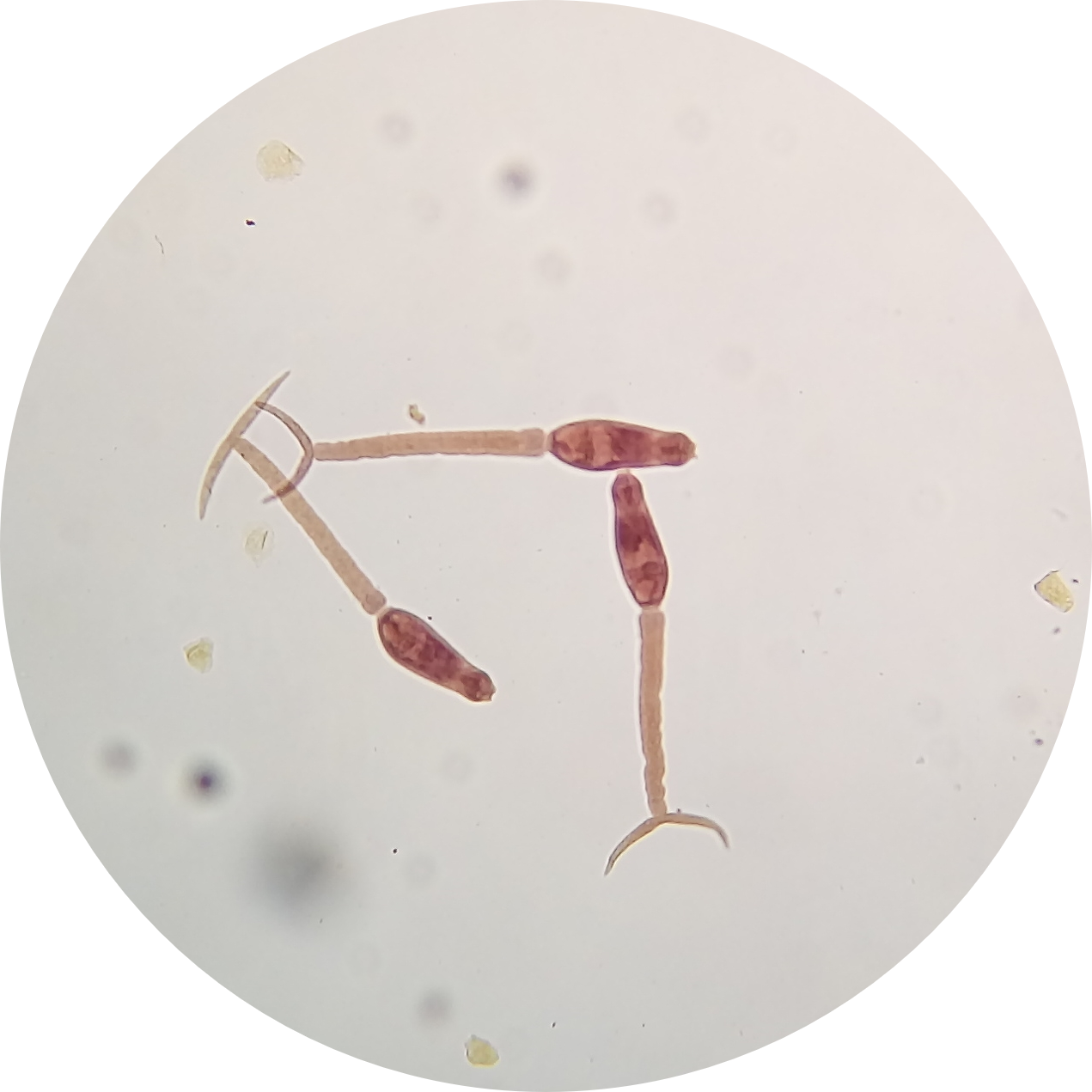 Schistosoma mansoni cercariae shed from an infected Biomphalaria snail