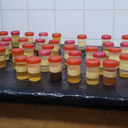 urine samples