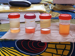 4 urine cups