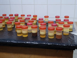 urine samples
