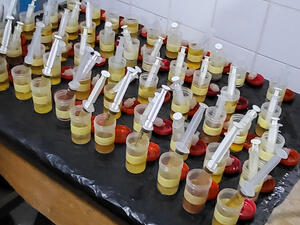urine samples syringes