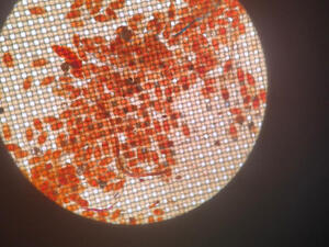 eggs