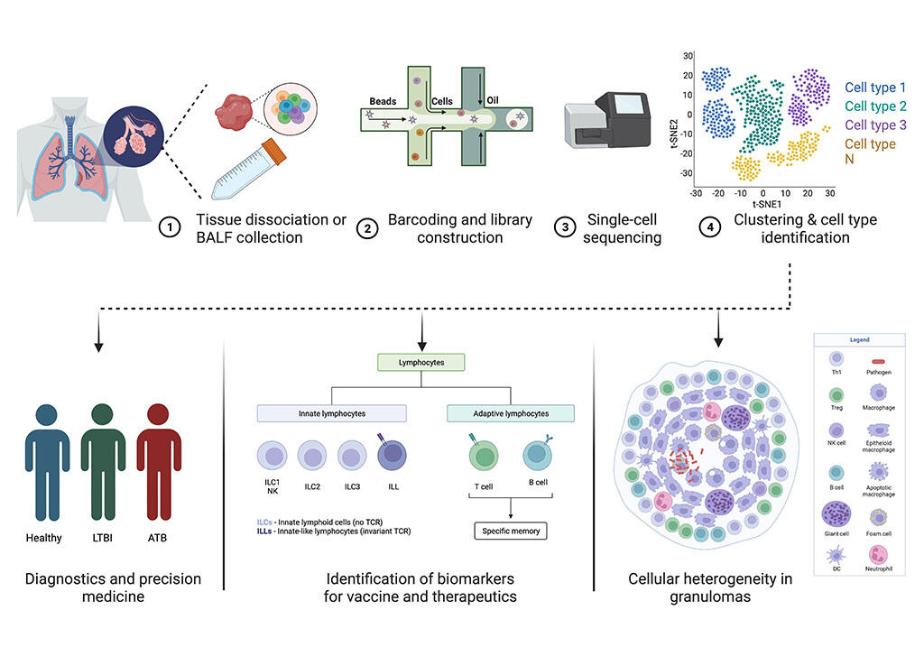 Scrna Seq In Tb Hiv Sharan Lab Scrna Seq In Tb Hiv Sharan Lab