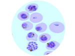 Malaria parasites in red blood cells