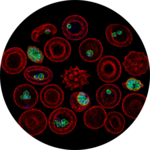 Malaria parasites in red blood cells (Fluorescent microscopy)