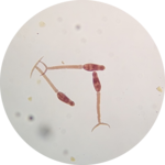 Schistosoma mansoni cercariae shed from an infected Biomphalaria snail